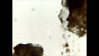 Demodex  killing in seconds with ethanol [upl. by Aidile]