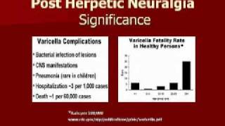 Pain Didactic Herpes Zoster and PHN  Pt 3 [upl. by Airotahs]