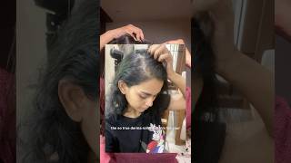 Derma rolling for hair growth [upl. by Kerby]