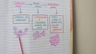 Pagets Disease Of Bone  Pathology [upl. by Chancey]