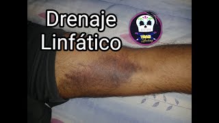 Kinesiotape para Drenaje Linfático Hematomas moretones [upl. by Richardo]