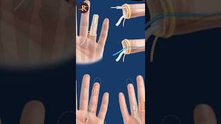 This is how you can reattach your finger science sciencefacts [upl. by Kaasi]