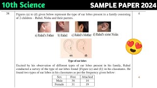 Figures a to d given below represent the type of ear lobes present in a family consisting of 2 [upl. by Ettevroc]