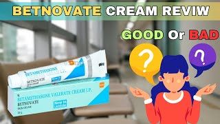 Uses and side effects of betnovate cream  Consultant Dermatologist [upl. by Gerrald547]