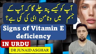 Signs of Vitamin E Deficiency  Vitamin of Youth  Dr Junaid Asghar [upl. by Popper52]