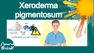 Xeroderma pigmentosum  What is the main cause of xeroderma pigmentosum  treatment of XP  USMLE [upl. by Garik]