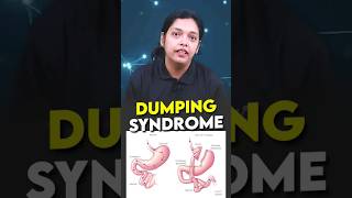 Dumping Syndrome Everything You Need To Know shorts sciencefacts dumpingsyndrome cds tap2crack [upl. by Ikik]