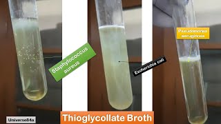 E coli  Staphylococcus aureus and Pseudomonas aeruginosa growth on Thioglycollate broth [upl. by Hilaire598]