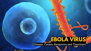 Ebola Virus Disease Causes Signs and Symptoms Diagnosis and Treatment [upl. by Dimphia]