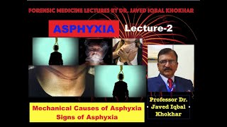 2 ASPHYXIA MECHANICAL CAUSES PATHOLOGY SIGNS SPECIFIC SIGNS NONSPECIFIC SIGNS asphyxia [upl. by Sapienza]