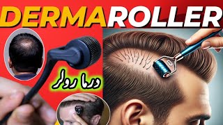 Microneedling  Derma Rolling for Hair Regrowth  Derma Roller Side Effects [upl. by Aletse]