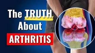 Osteoarthritis vs Rheumatoid Arthritis in Hindi Full detail jointpain [upl. by Doro]