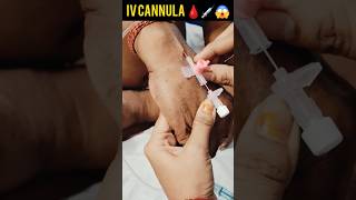 IV Cannula technic 🩸💉😱🙏🏥😡intravenousfluid ivinsertion trending shorts [upl. by Eussoj]