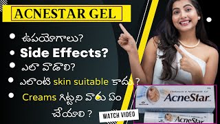 Acnestar PIMPLE clear gel in Telugu  Uses Side Effects and How to use  Most used cream in Market [upl. by Dnomder]