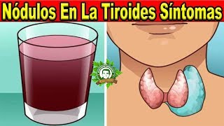 Nódulos En La Tiroides Síntomas y Tratamiento Natural Prueba Este Jugo y Bébelo De Esta Forma [upl. by Vastha]