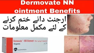 Dermovate NN ointmentHow to use dermovate for skin fungal infections remove acne pimple scar [upl. by Malita]