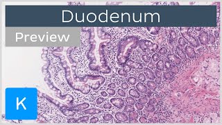 Duodenum histology slide tissues and cells preview  Human Histology  Kenhub [upl. by Enilrahc]