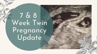 7 amp 8 Weeks Pregnant With Twins Update [upl. by Galina]