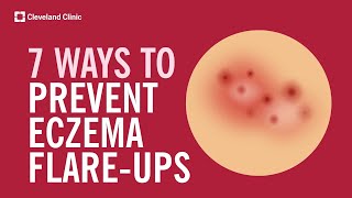 7 Ways to Prevent Eczema FlareUps [upl. by Schechinger495]