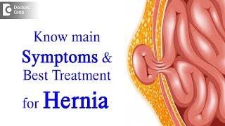 What is Hernia Symptoms Causes Types Treatment  Dr Harish N S  Doctors Circle [upl. by Alleacim723]