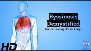 Byssinosis Unmasked Delving into the Causes and Symptoms of Brown Lungs [upl. by Corydon105]