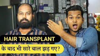 HAIR TRANSPLANT के बाद Again Hair FALL Hair Transplant Review After 45 Days  shedding PHASE [upl. by Portingale]