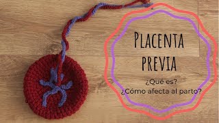 PLACENTA PREVIA o PLACENTA BAJA · ¿Qué es ¿Cómo afecta al parto [upl. by Dill]