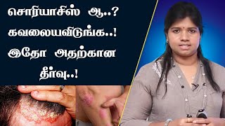 சொரியாசிஸ் பிரச்சனைக்கு நிரந்தர தீர்வு  Psoriasis Symptoms Causes amp Treatment  Dr BYoga Vidhya [upl. by Nosirrah]