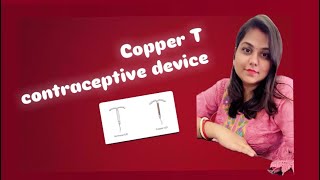 Copper T  contraceptive device [upl. by Gunner]