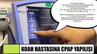 KOAH HASTASINA CPAP YAPILIŞI [upl. by Broadbent]