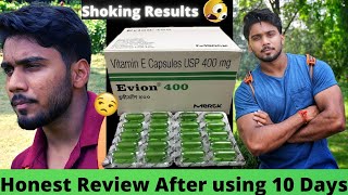 Evion 400 Capsules Honest Review after using 10 Days  Uses Benefits Side Effects [upl. by Yanel315]