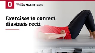 Exercises to correct diastasis recti  Ohio State Medical Center [upl. by Dnalel]