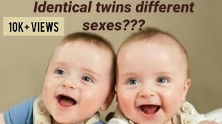 IDENTICAL TWINS DIFFERENT SEXES  Rare types of twins  twins  Sukanya Good Vibes [upl. by Annawik]