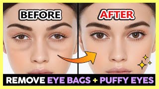 ✨ REMOVE UNDER EYE BAGS PUFFY EYES SWOLLEN EYES PERMANENTLY  GET BRIGHT EYES amp BEAUTIFUL EYES [upl. by Stockton719]