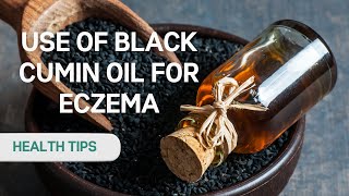 Want to Say Goodbye to Eczema Watch This Black Seed Oil Video Now [upl. by Einahets]