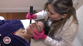 REJUVENECIMIENTO FACIAL CON CELULAS MADRE [upl. by Ainimre]