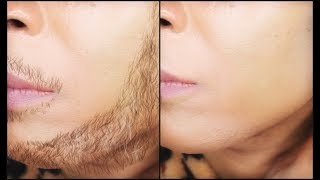 The shocking secret to removing facial hair permanently  Khichi Beauty [upl. by Nilat]