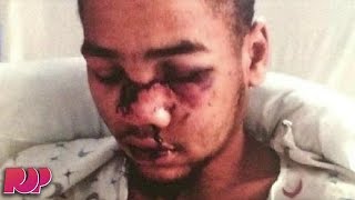 Boy Shot In The Face After Being SWATTED By Angry Gamer [upl. by Evania]