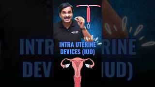 Know about Intra Uterine Device IUD  Ideal Contraceptive Device foryou neetpreparation iud [upl. by Trilby638]