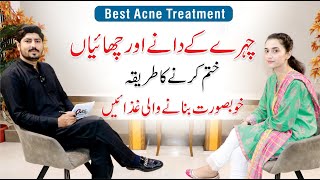 Pimples and Acne Treatment At Home  Skin Care Routine  Dr Huria Arooj  Dr AR Madha [upl. by Yeruoc]