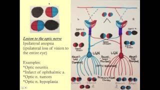 Neuroopthalmology  CRASH Medical Review Series [upl. by Mattson]