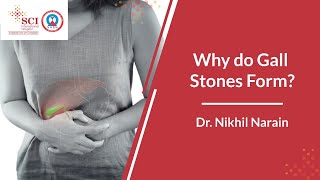 Why Do Gall Stones Form  Gall Stones Formation Explained  SCI Hospital [upl. by Neleag733]