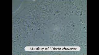 Bacteria motility1  Darting  V cholera [upl. by Arramat]