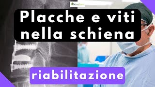 Placche e viti nella schiena riabilitazione [upl. by Notle783]