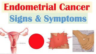 Endometrial Cancer Signs amp Symptoms amp Why They Occur [upl. by Carce535]