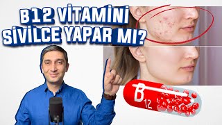 B12 Vitamini SİVİLCE Yapar Mı Neden Sivilce Yapar [upl. by Stoller]