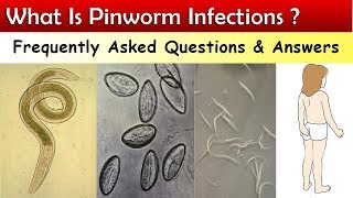 What Is Pinworm Infections   FAQ amp Answers [upl. by Aehtorod]