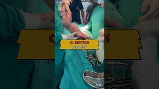 CESAREAN BIRTH 🤱🩺🏥 ankur maitrika hospital NEWBORN CARE JAMMU [upl. by Gonzales]