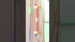 dialysis process animation dialysistechnician kidney bloodcleanser [upl. by Oelak]