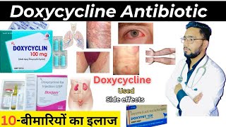 Doxycycline  एंटीबायोटिक  Medicine  Treatment  Antibiotics  doxycycline medicine Used [upl. by Hobart205]